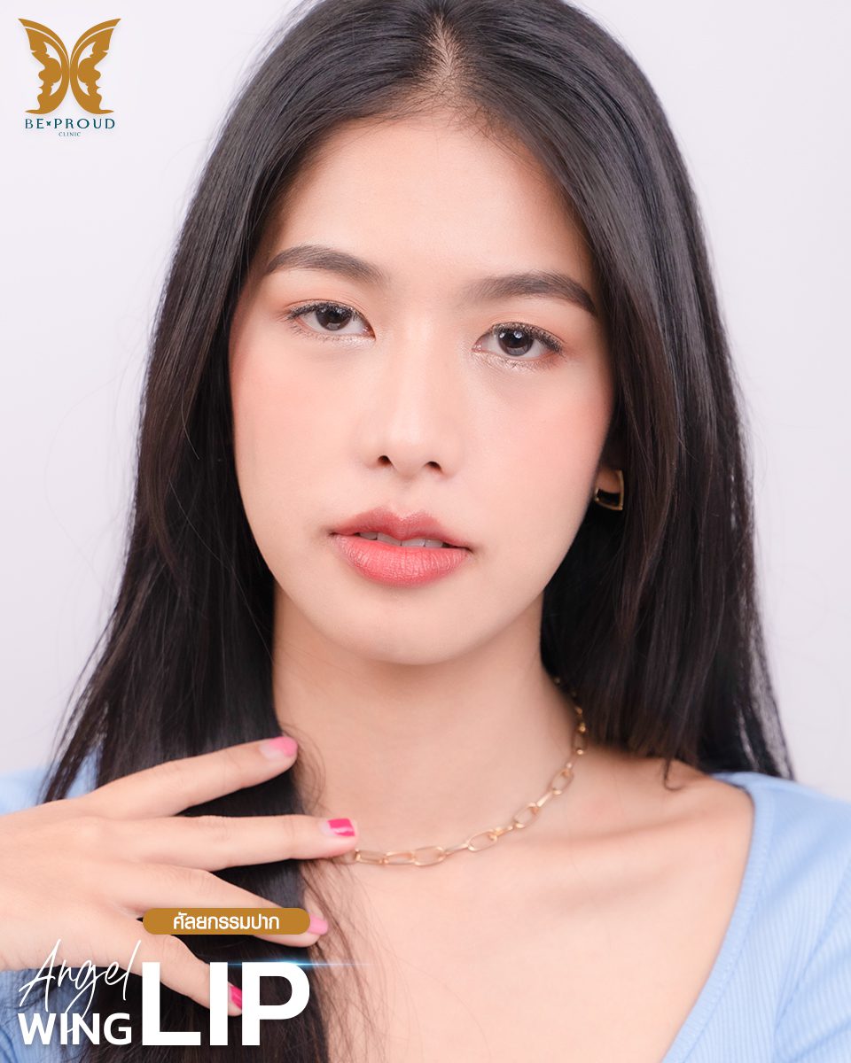 ปากกระจับปีกนางฟ้า-10 ปากกระจับปีกนางฟ้า-10