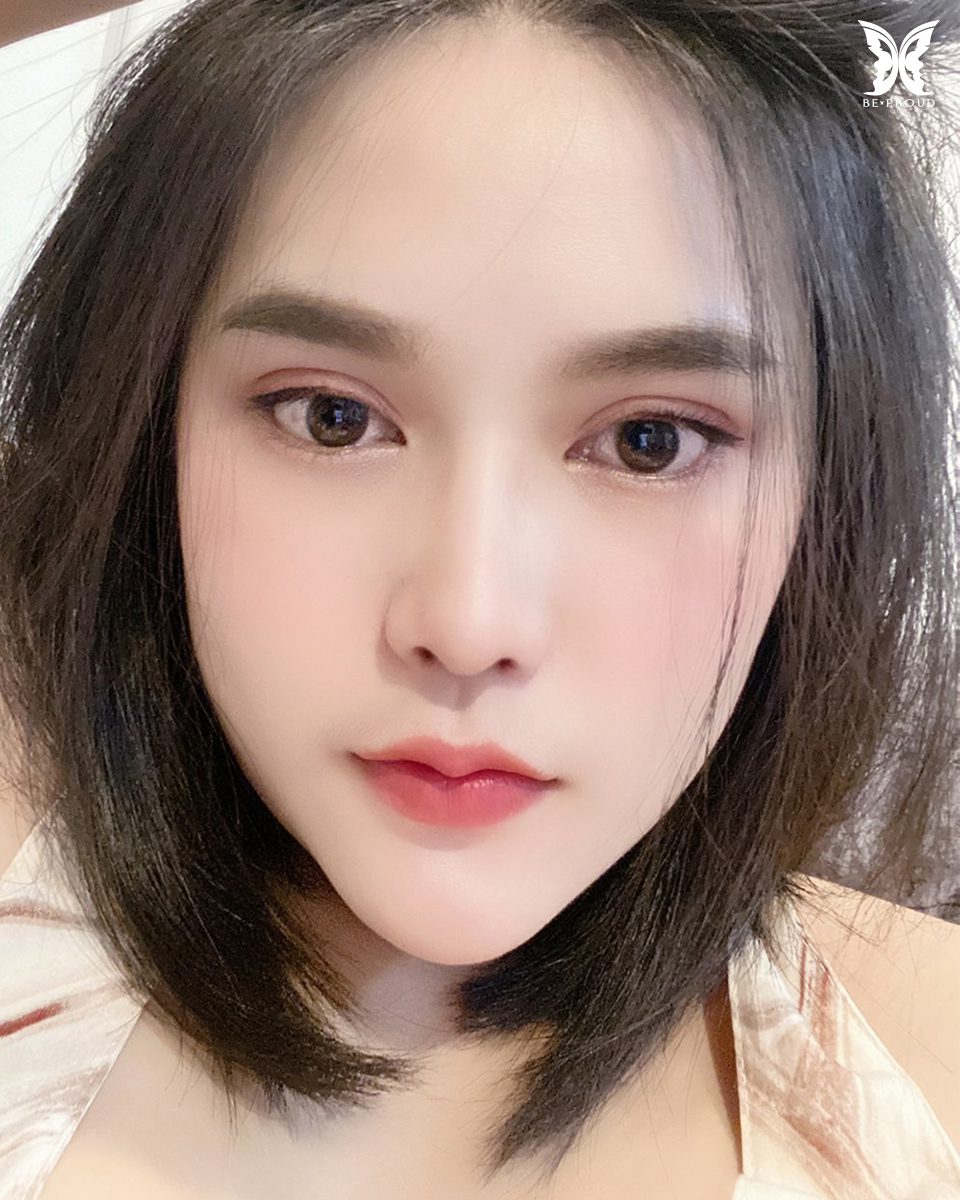 รีวิวตาสองชั้นกรีดยาวแผลมินิ-12