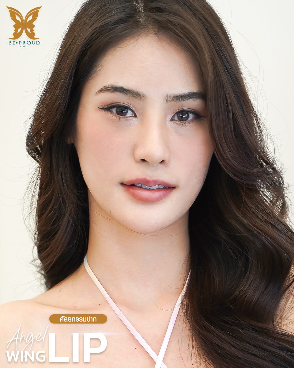 ปากกระจับปีกนางฟ้า-07 ปากกระจับปีกนางฟ้า-07