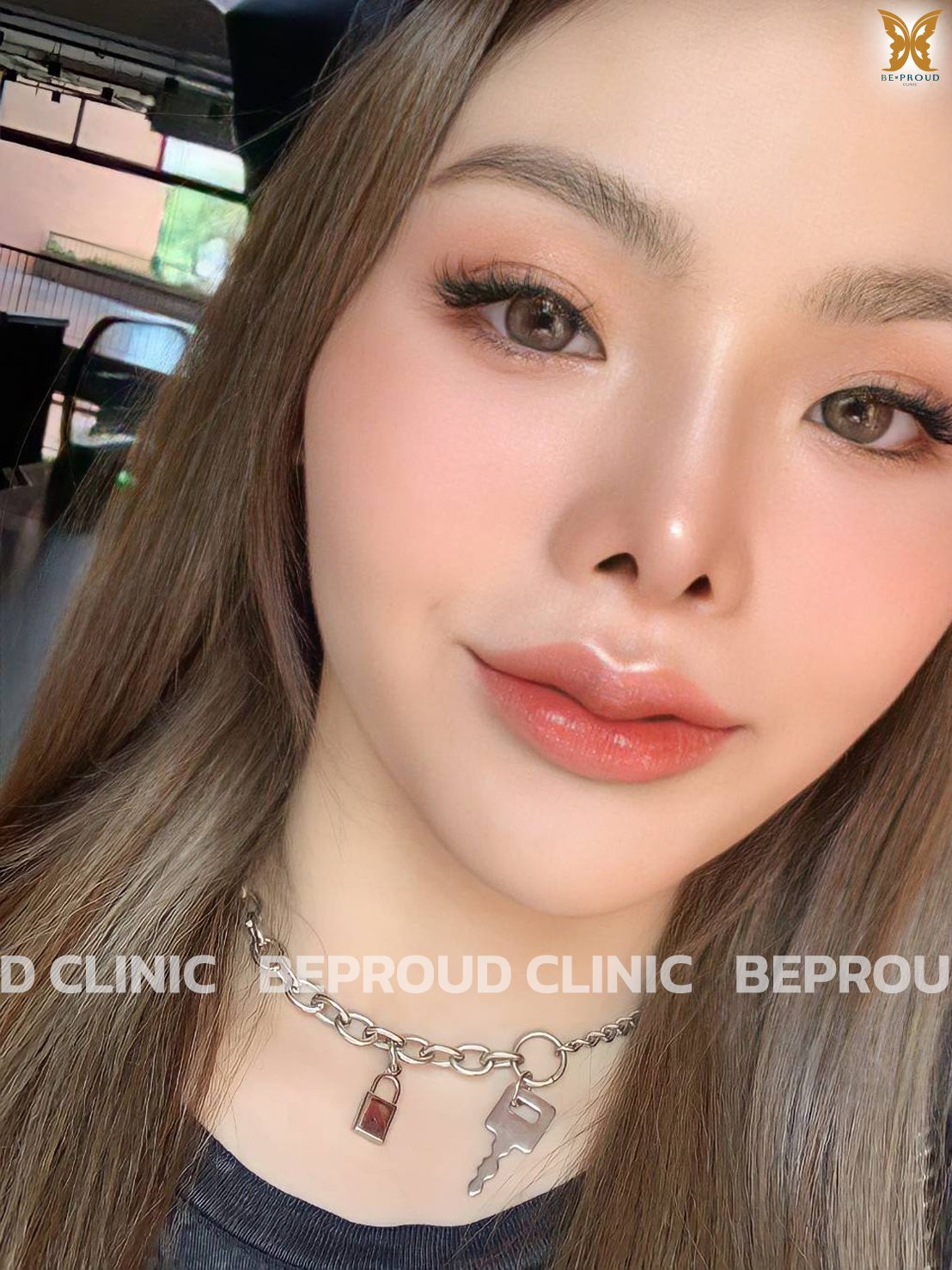 เช็ค &lsquo;ฟิลเลอร์แท้&rsquo; ยี่ห้อไหนดี พร้อมรีวิว