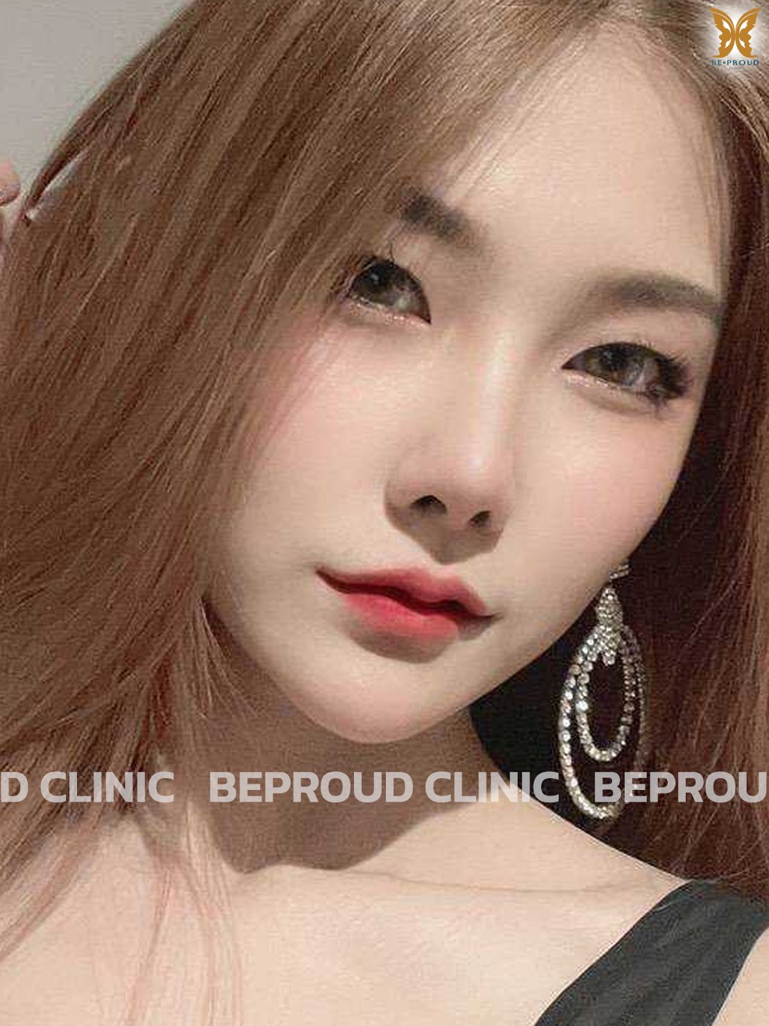 เช็ค &lsquo;ฟิลเลอร์แท้&rsquo; ยี่ห้อไหนดี พร้อมรีวิว