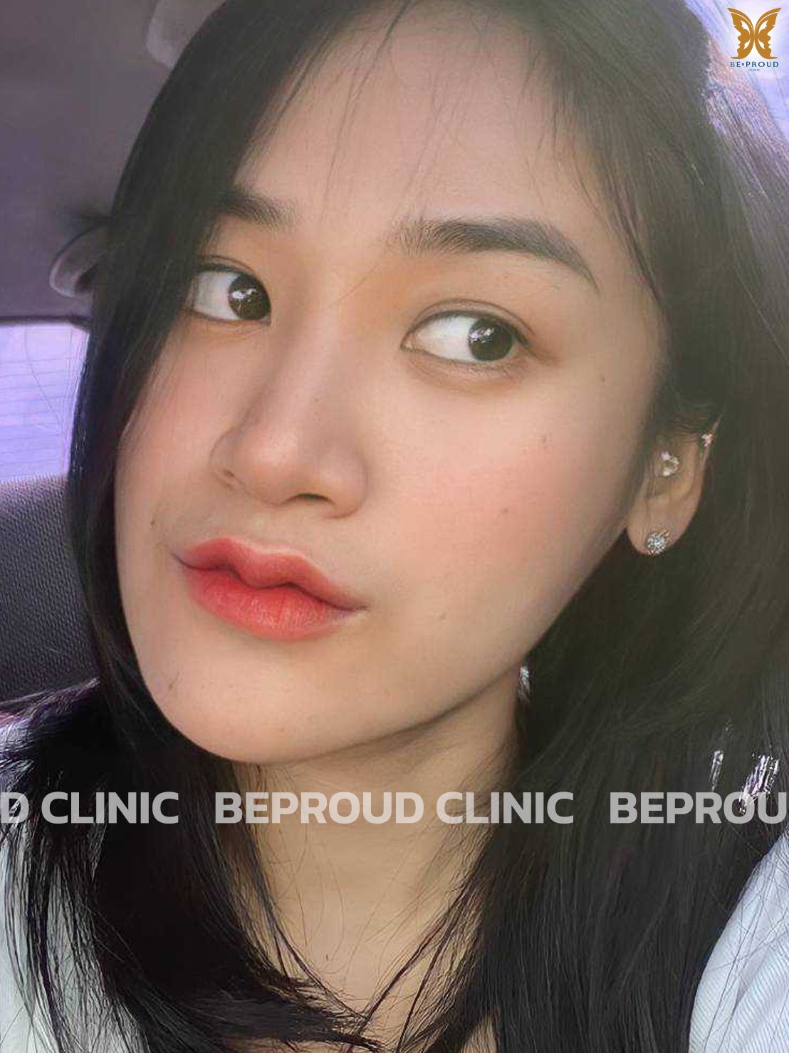 เช็ค &lsquo;ฟิลเลอร์แท้&rsquo; ยี่ห้อไหนดี พร้อมรีวิว