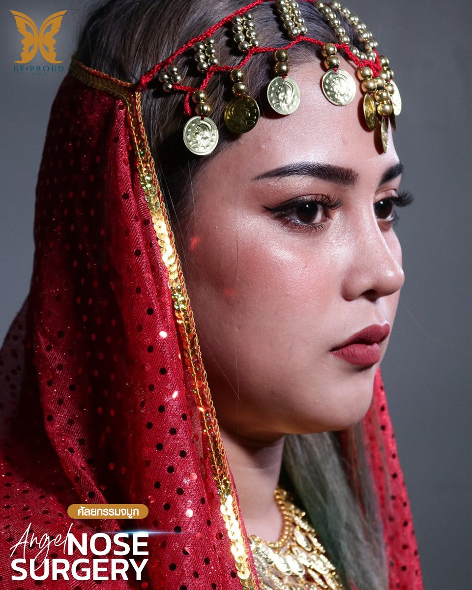รีวิวเสริมจมูก-11 รีวิวเสริมจมูก-11