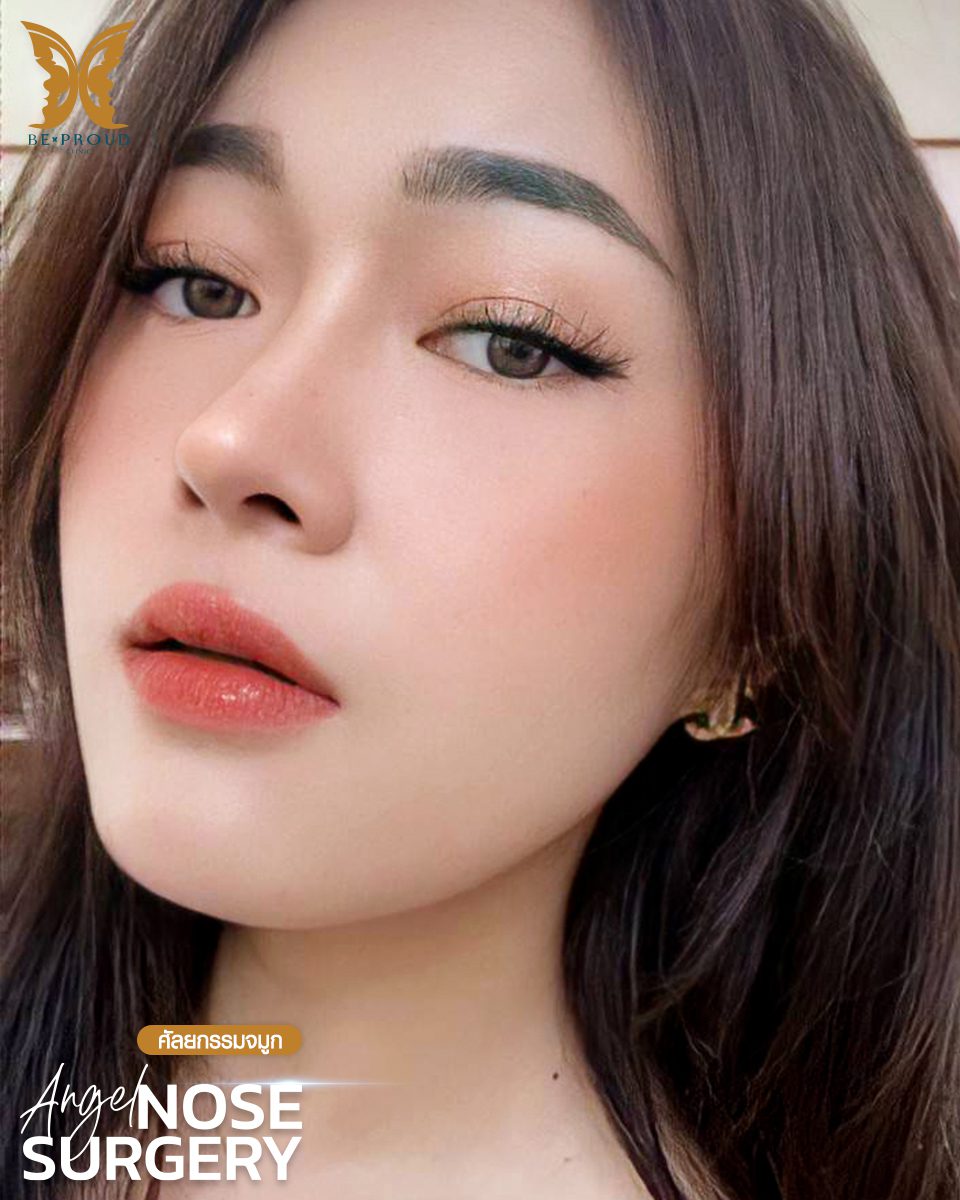 รีวิวเสริมจมูก-10 รีวิวเสริมจมูก-10