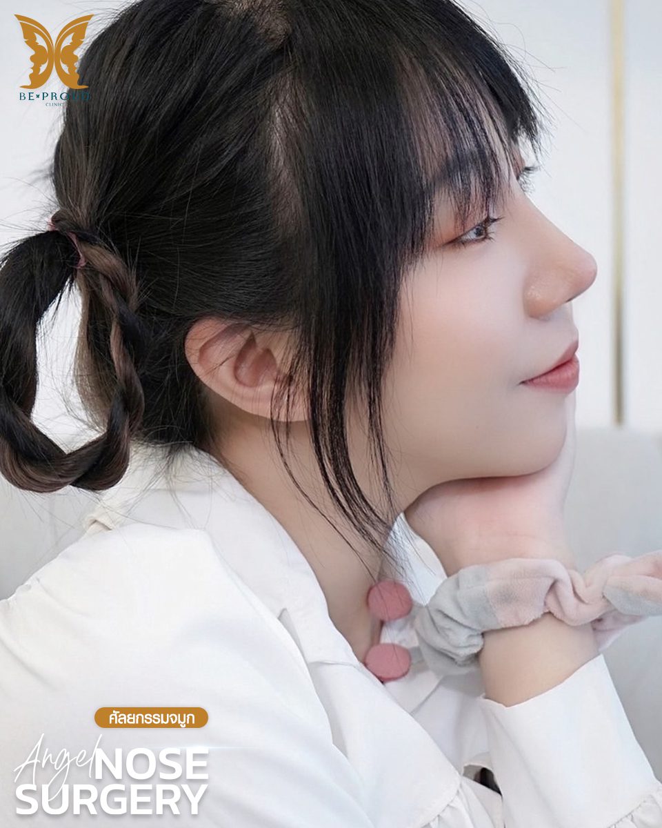 รีวิวเสริมจมูก-05 รีวิวเสริมจมูก-05