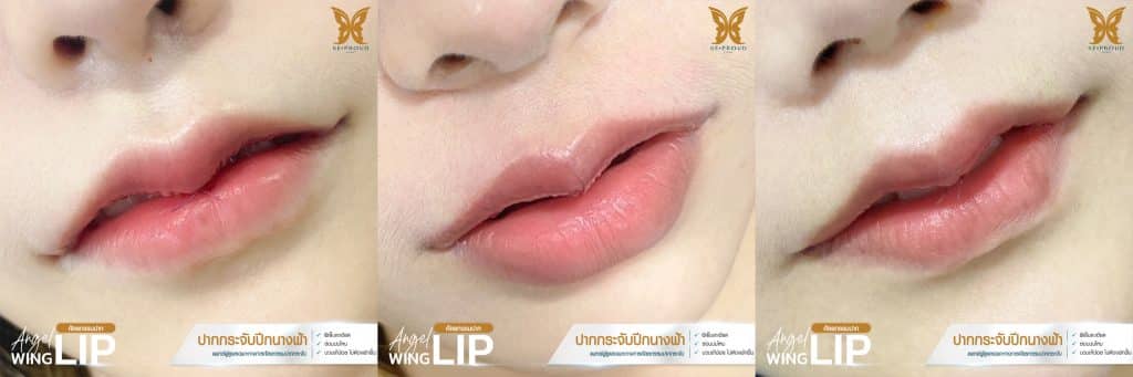 รวมฝีเย็บ-02 รวมฝีเย็บ-02