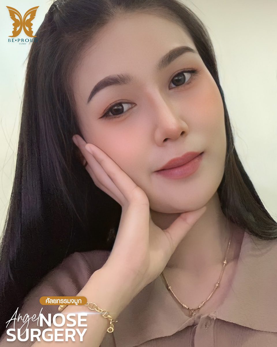 รีวิวเสริมจมูก(2) รีวิวเสริมจมูก(2)