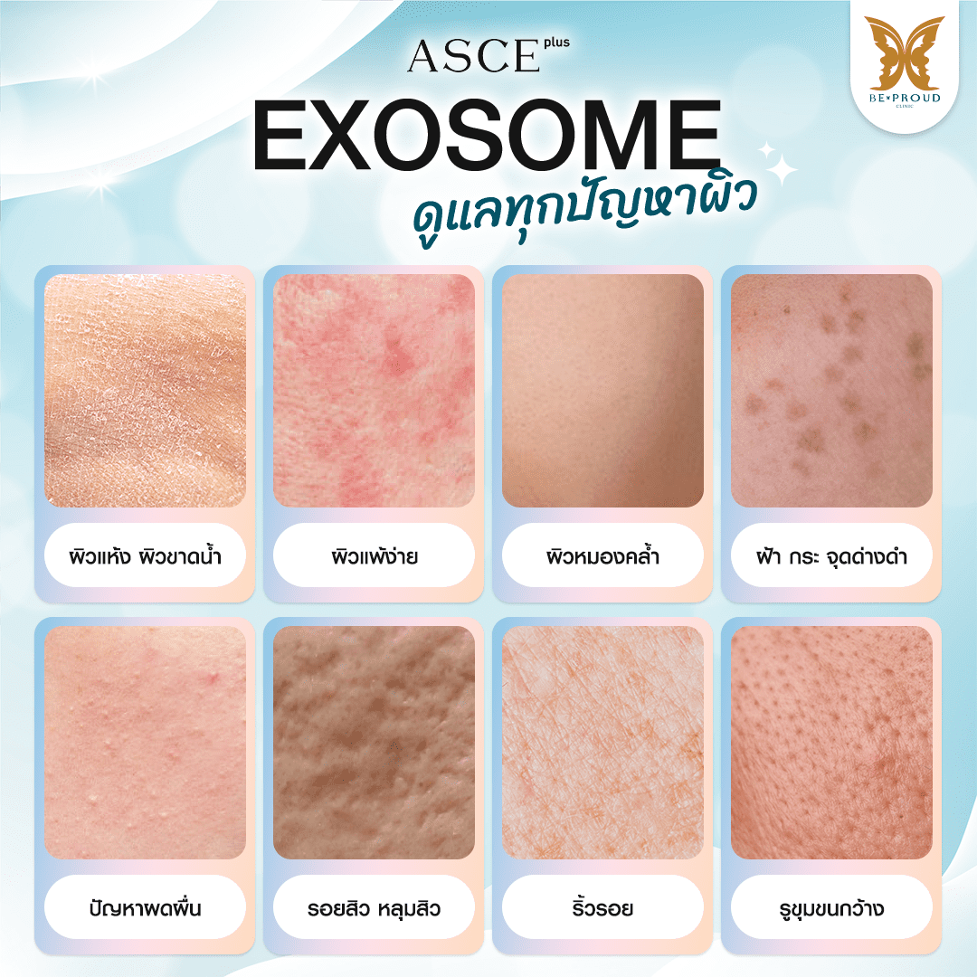 Exosome เหมาะกับใคร Exosome เหมาะกับใคร