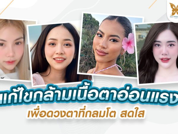 กล้ามเนื้อตาอ่อนแรง