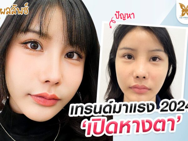 เปิดหางตา