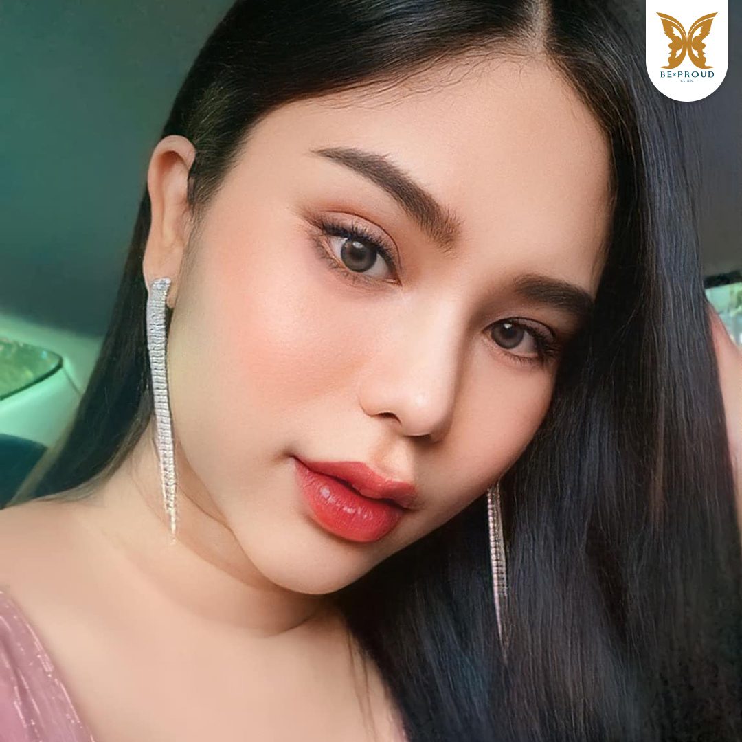 ผลลัพธ์ตาสองชั้น ผลลัพธ์ตาสองชั้น