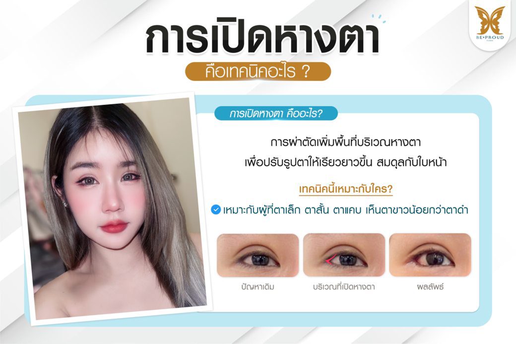วิธีการเปิดหางตา วิธีการเปิดหางตา