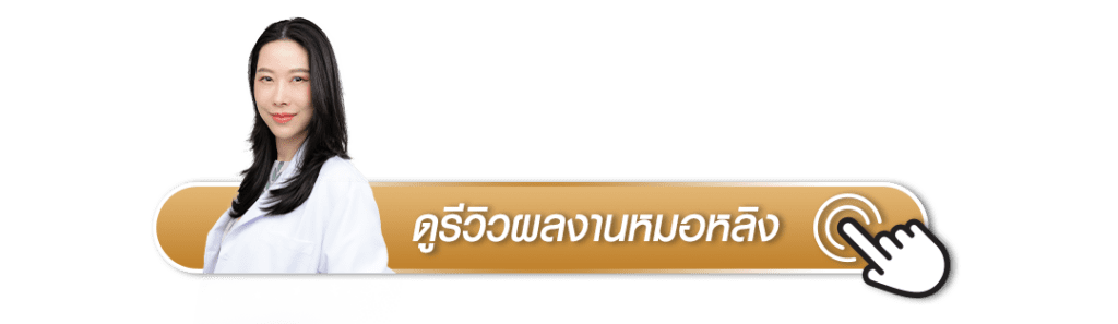 ดูรีวิวผลงานหมอหลิงเพิ่มเติม