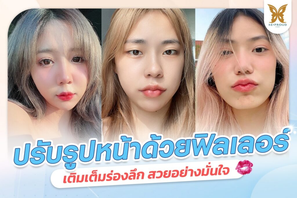 ฟิลเลอร์