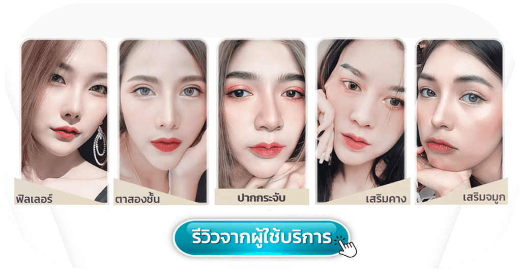 ฟิลเลอร์