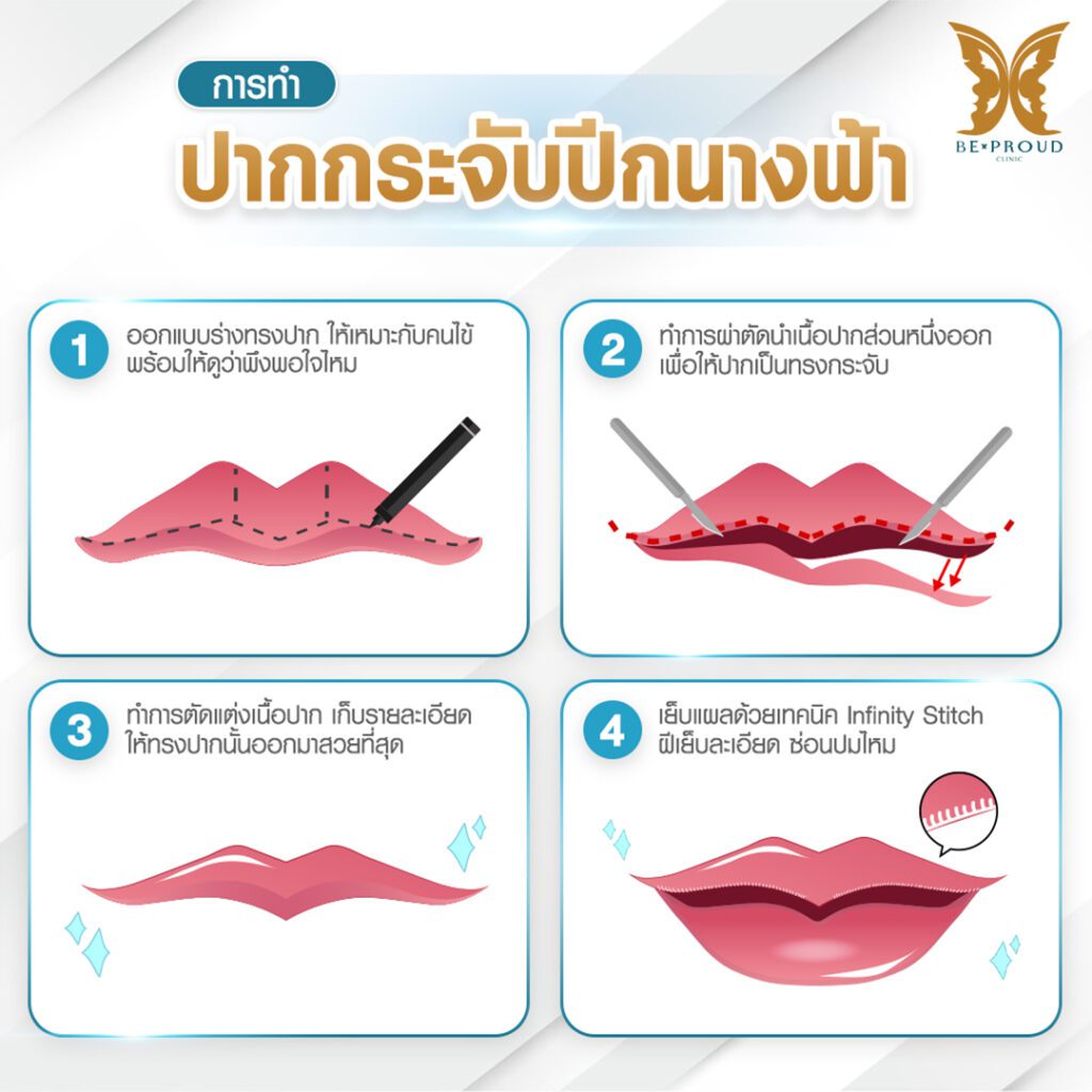 ปากกระจับ