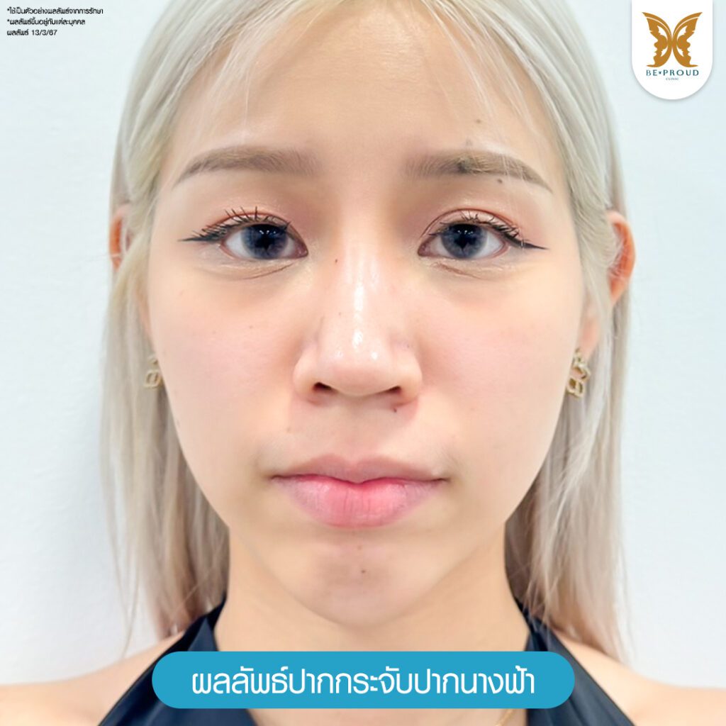 ปากกระจับ