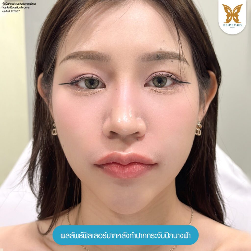 ปากกระจับ