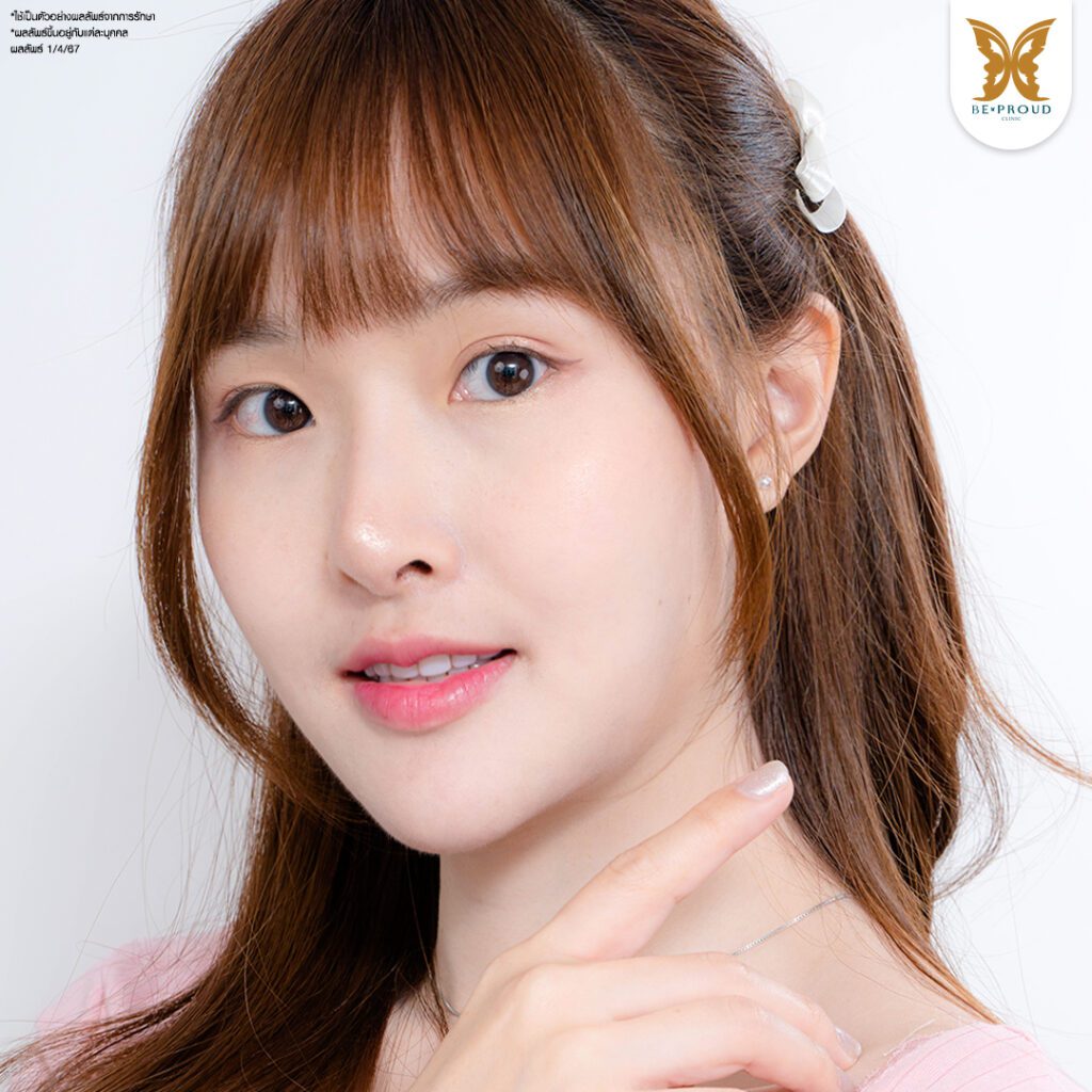 ปากกระจับ