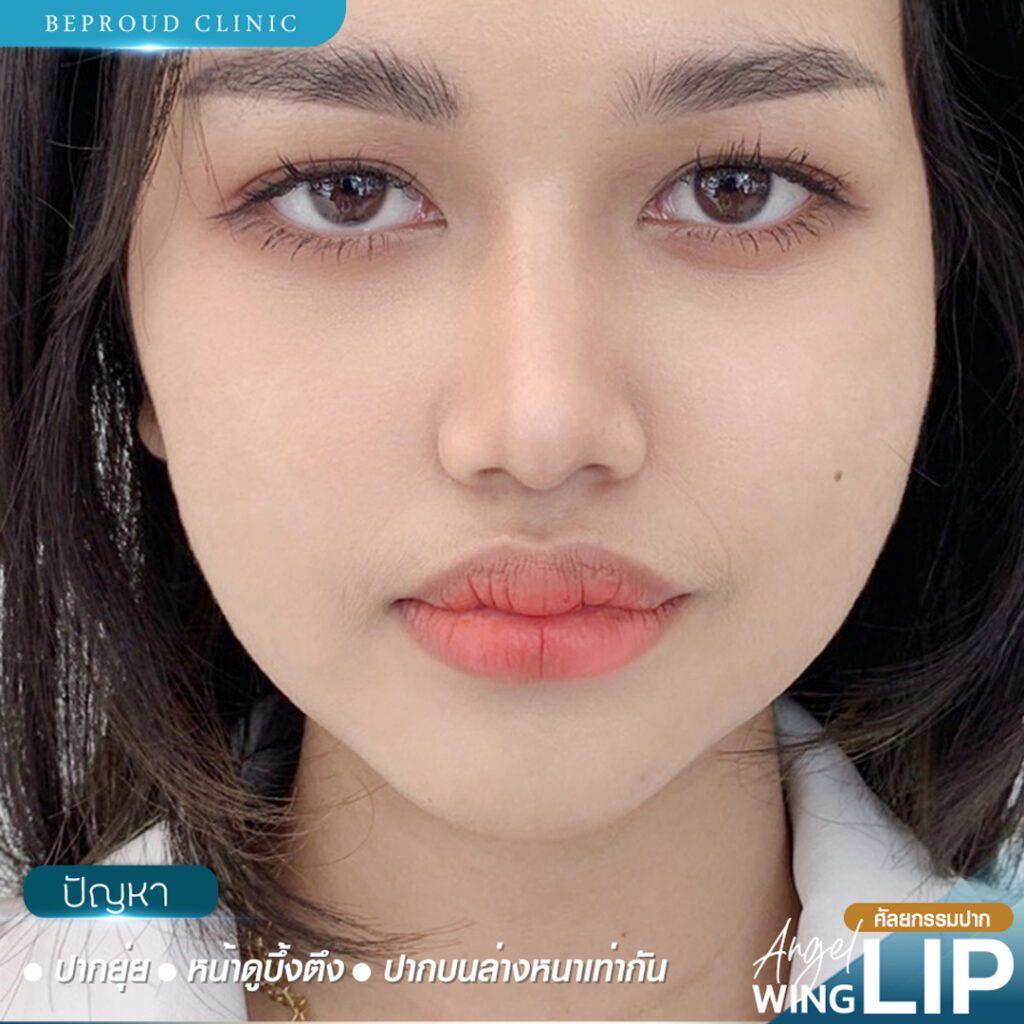 ปากกระจับ