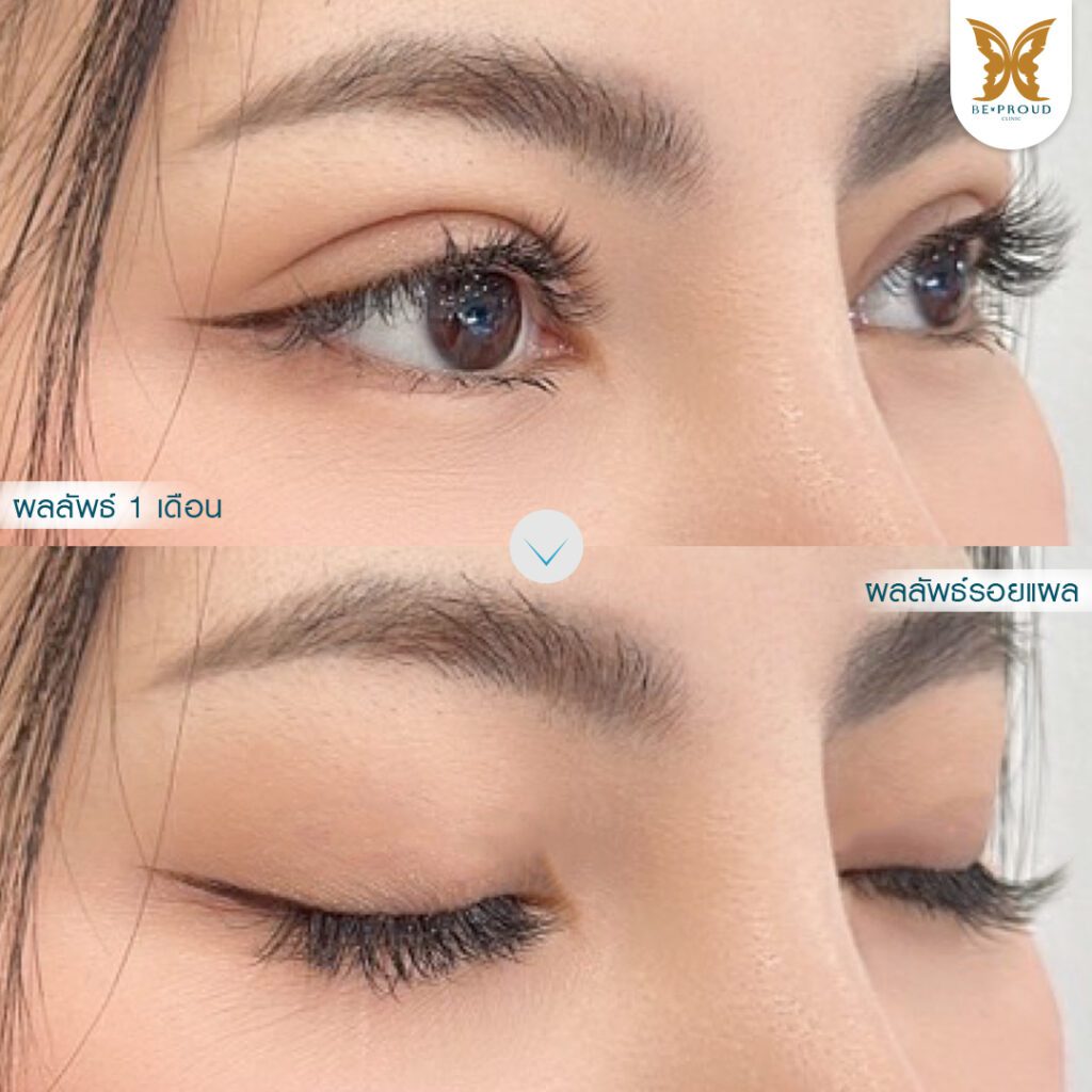 ทำตากับจักษุแพทย์