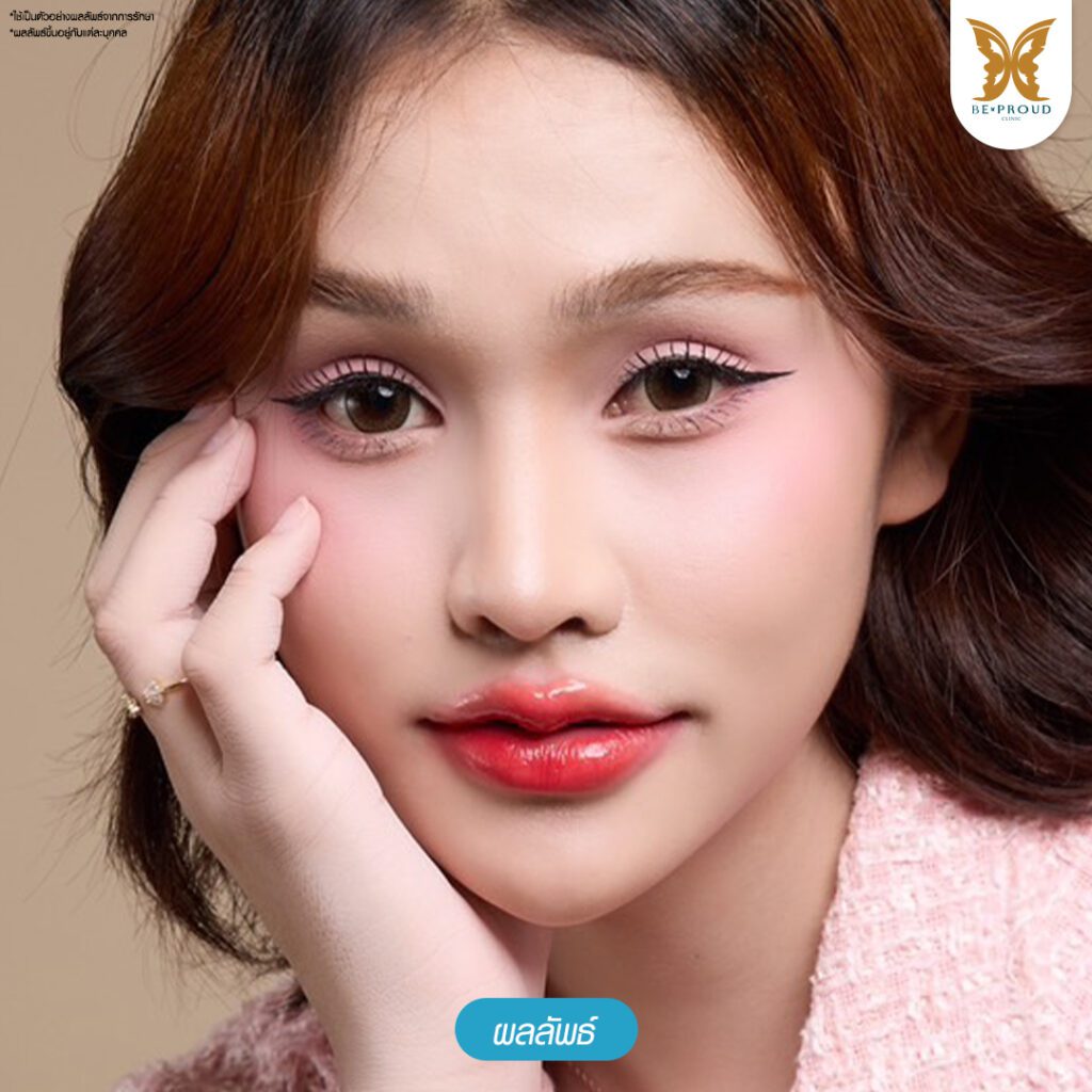 ปากกระจับ ศัลยกรรมปากกระจับ ฟิลเลอร์ปาก