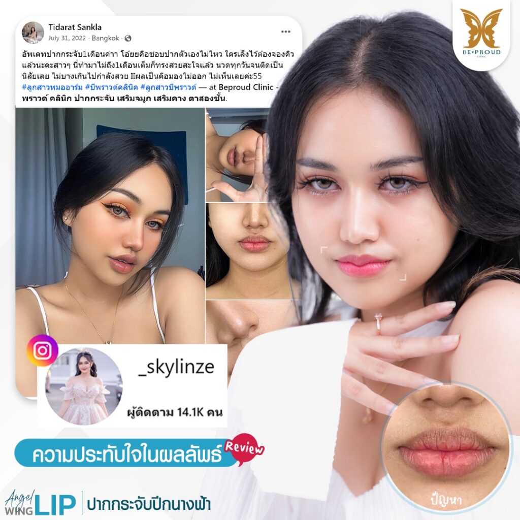 ฉลองครบ7ปีกับบีพราวด์ บีพราวด์คลินิก BeproudBeYourself