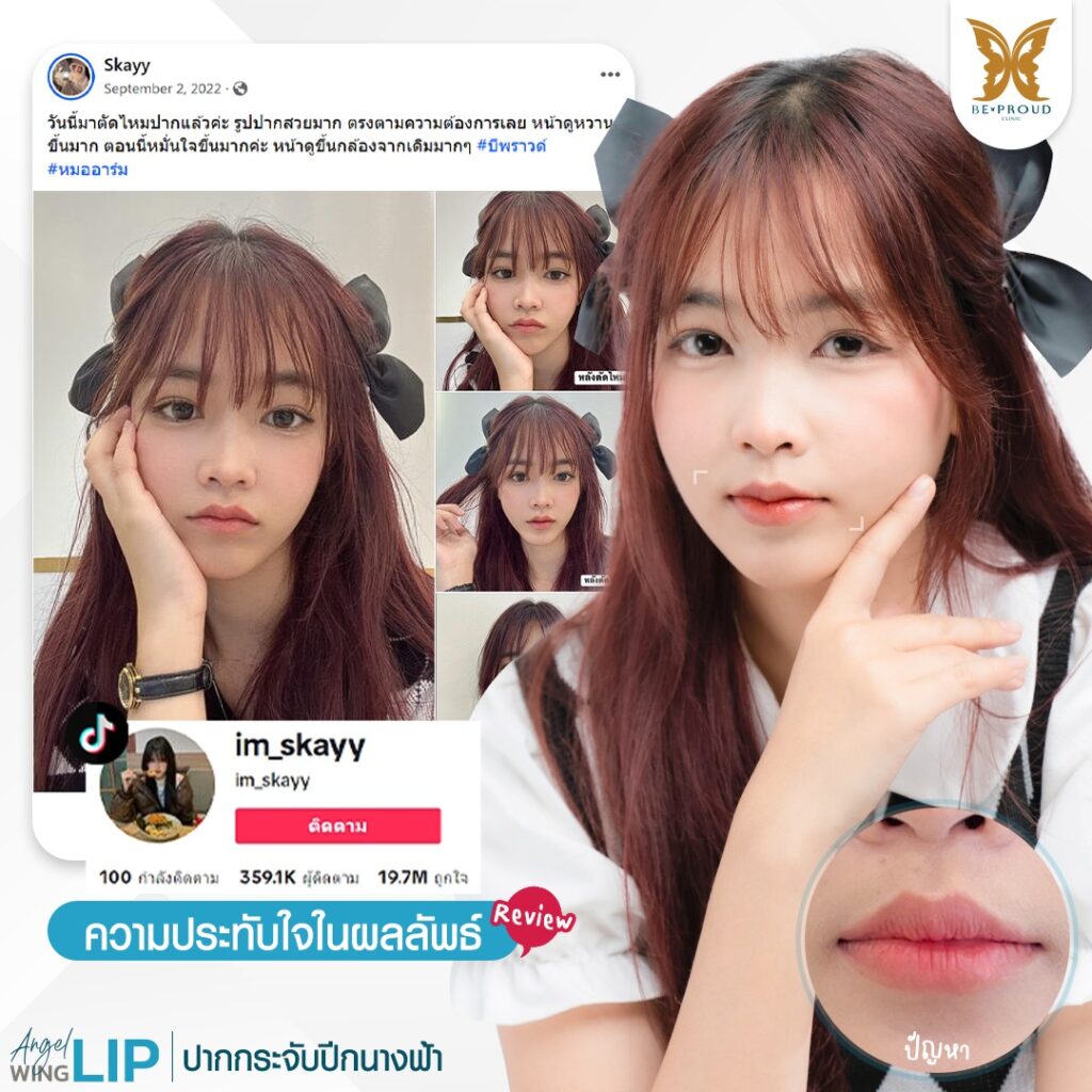ฉลองครบ7ปีกับบีพราวด์ บีพราวด์คลินิก BeproudBeYourself