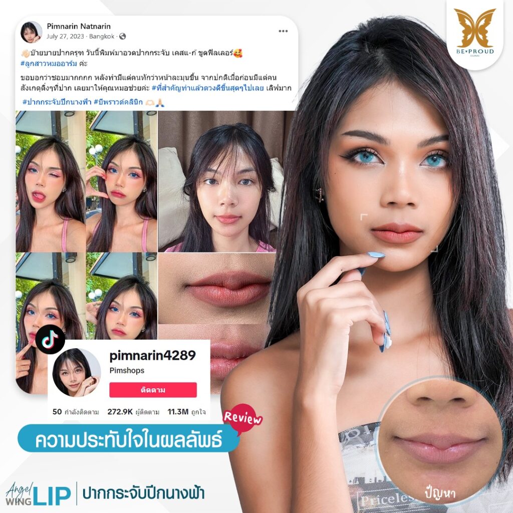 ฉลองครบ7ปีกับบีพราวด์ บีพราวด์คลินิก BeproudBeYourself