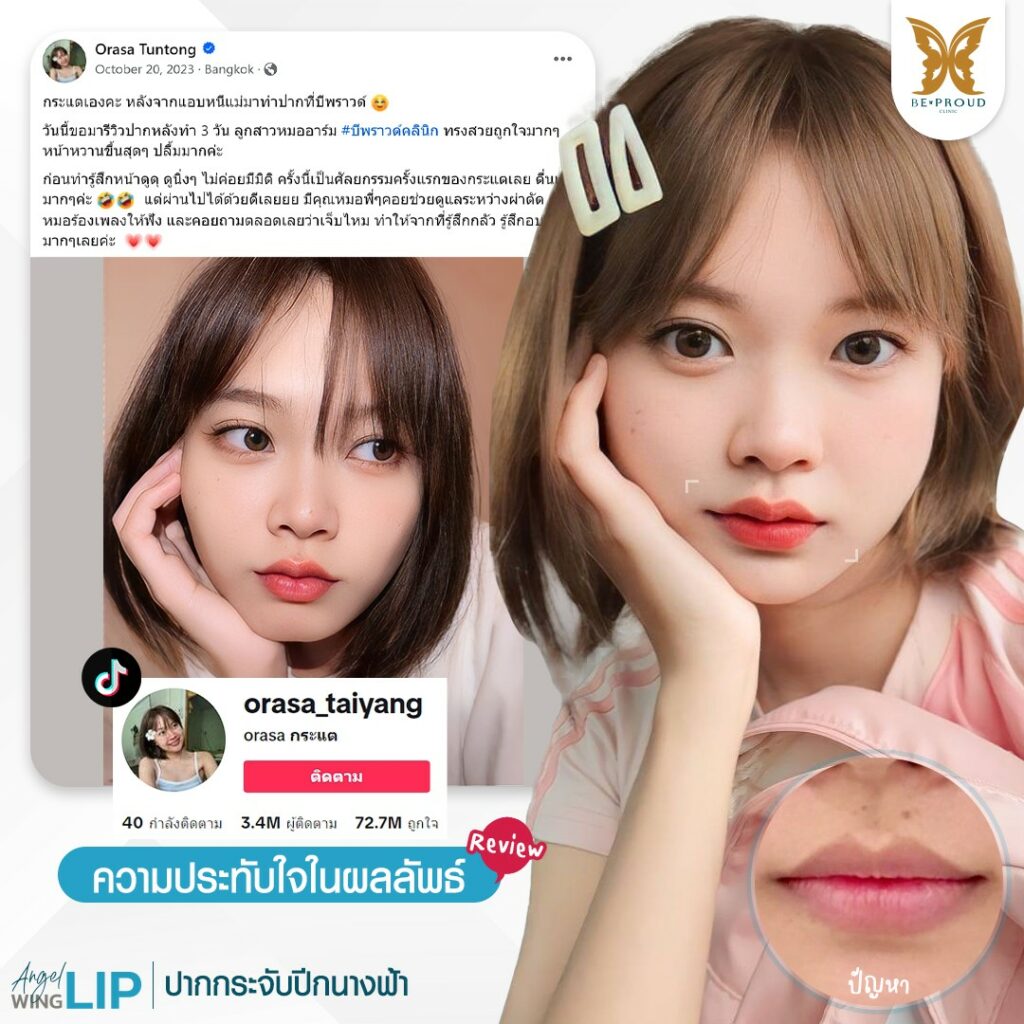 ฉลองครบ7ปีกับบีพราวด์ บีพราวด์คลินิก BeproudBeYourself
