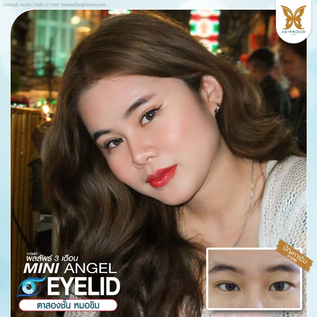 ฉลองครบ7ปีกับบีพราวด์ บีพราวด์คลินิก BeproudBeYourself