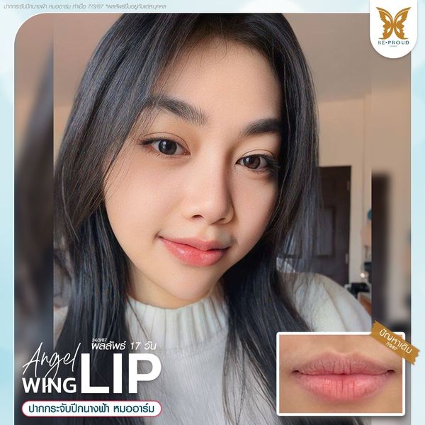 ฉลองครบ7ปีกับบีพราวด์ บีพราวด์คลินิก BeproudBeYourself