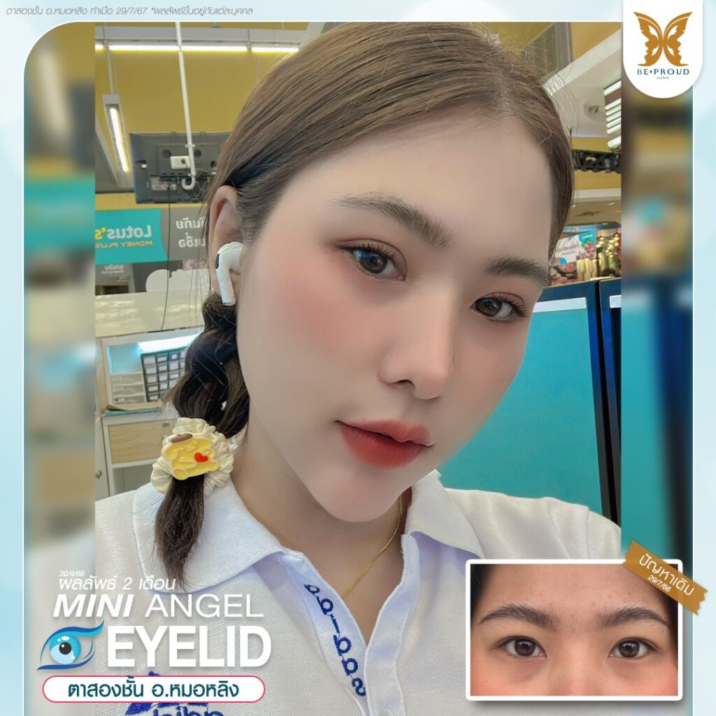 ฉลองครบ7ปีกับบีพราวด์ บีพราวด์คลินิก BeproudBeYourself