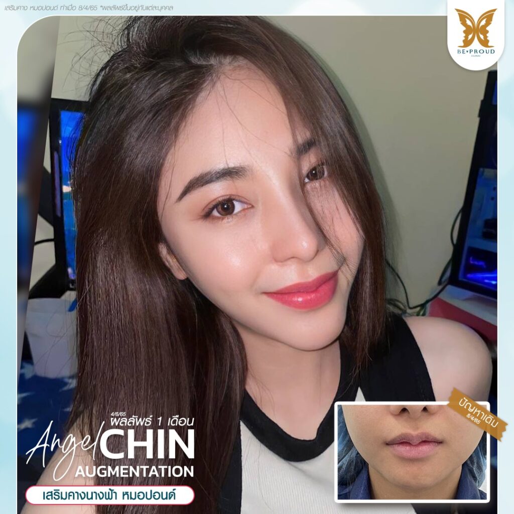 ฉลองครบ7ปีกับบีพราวด์ บีพราวด์คลินิก BeproudBeYourself