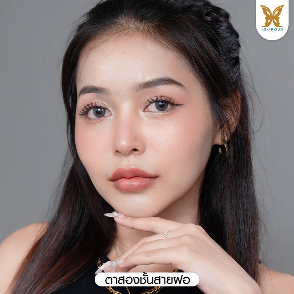 ตาสองชั้น ชั้นตาเล็ก ตาสองชั้นแบบธรรมชาติ