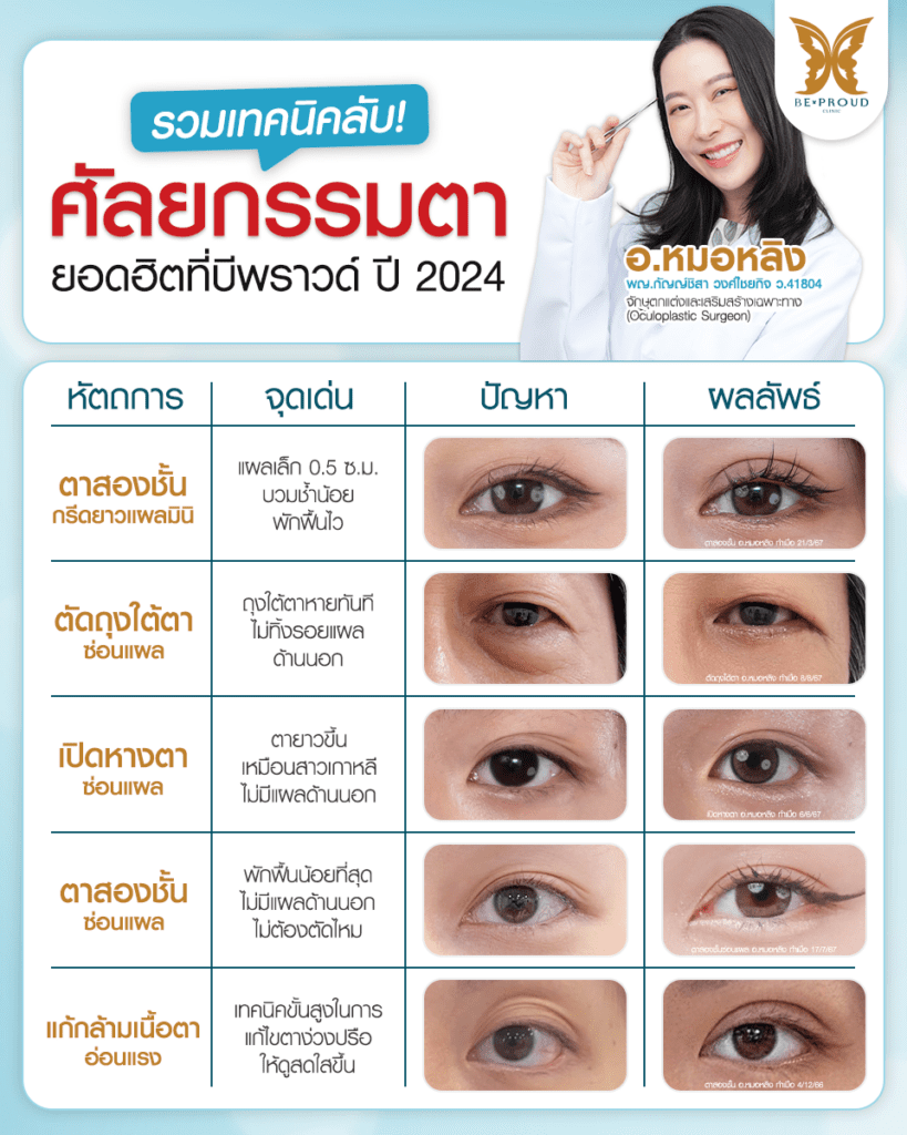 เทคนิคพิเศษตา หมอหลิง