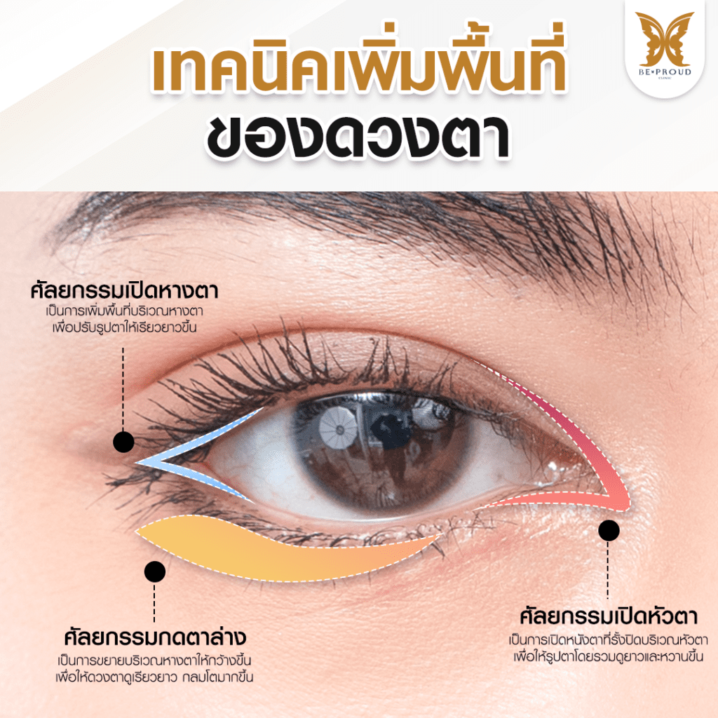 เทคนิคพิเศษตา หมอหลิง