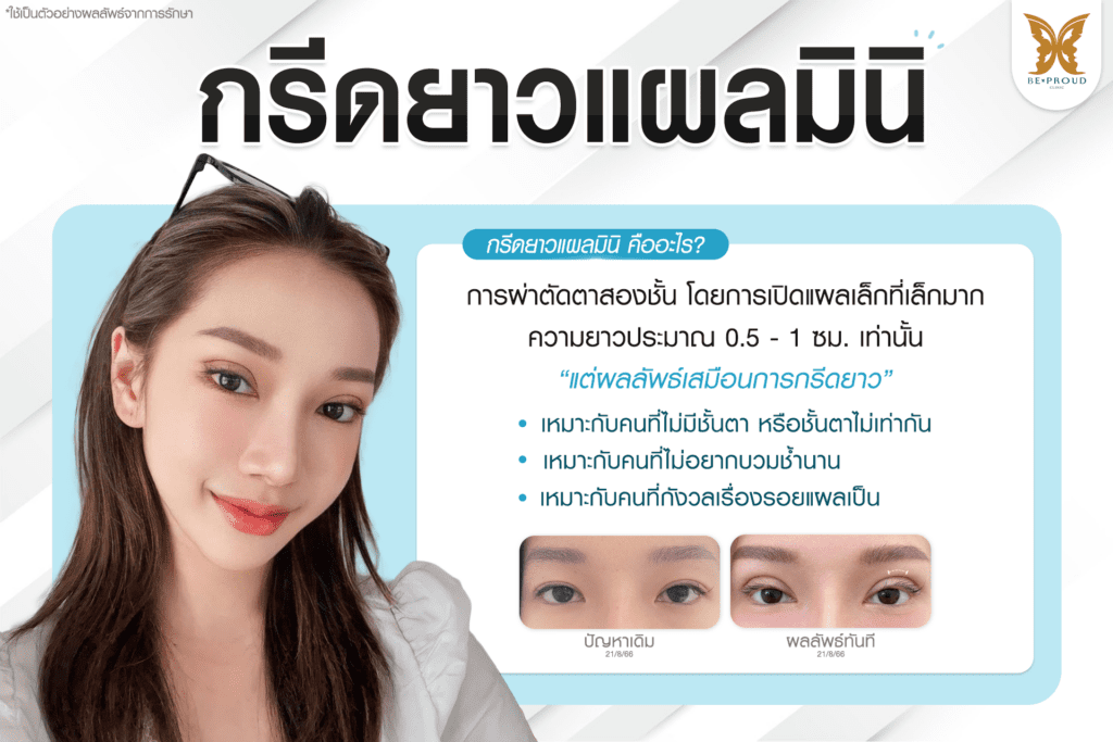 เทคนิคพิเศษตา หมอหลิง