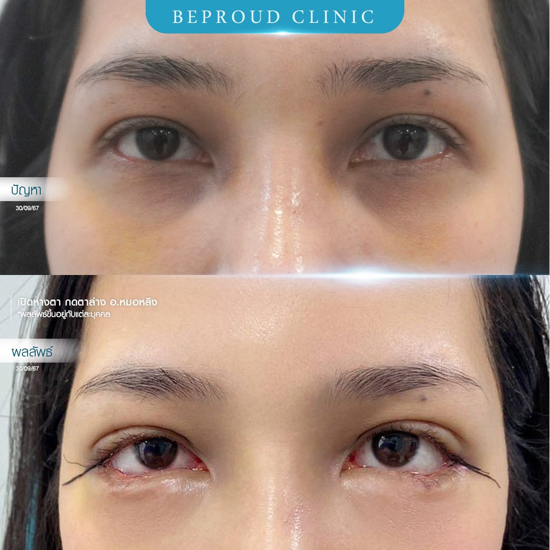 เปิดหางตา