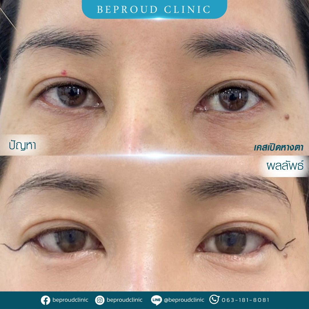 เปิดหางตา