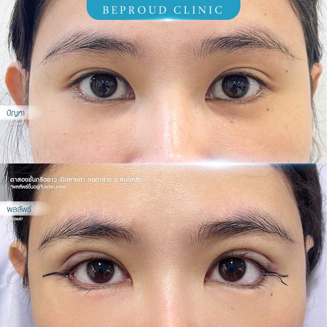 เปิดหางตา