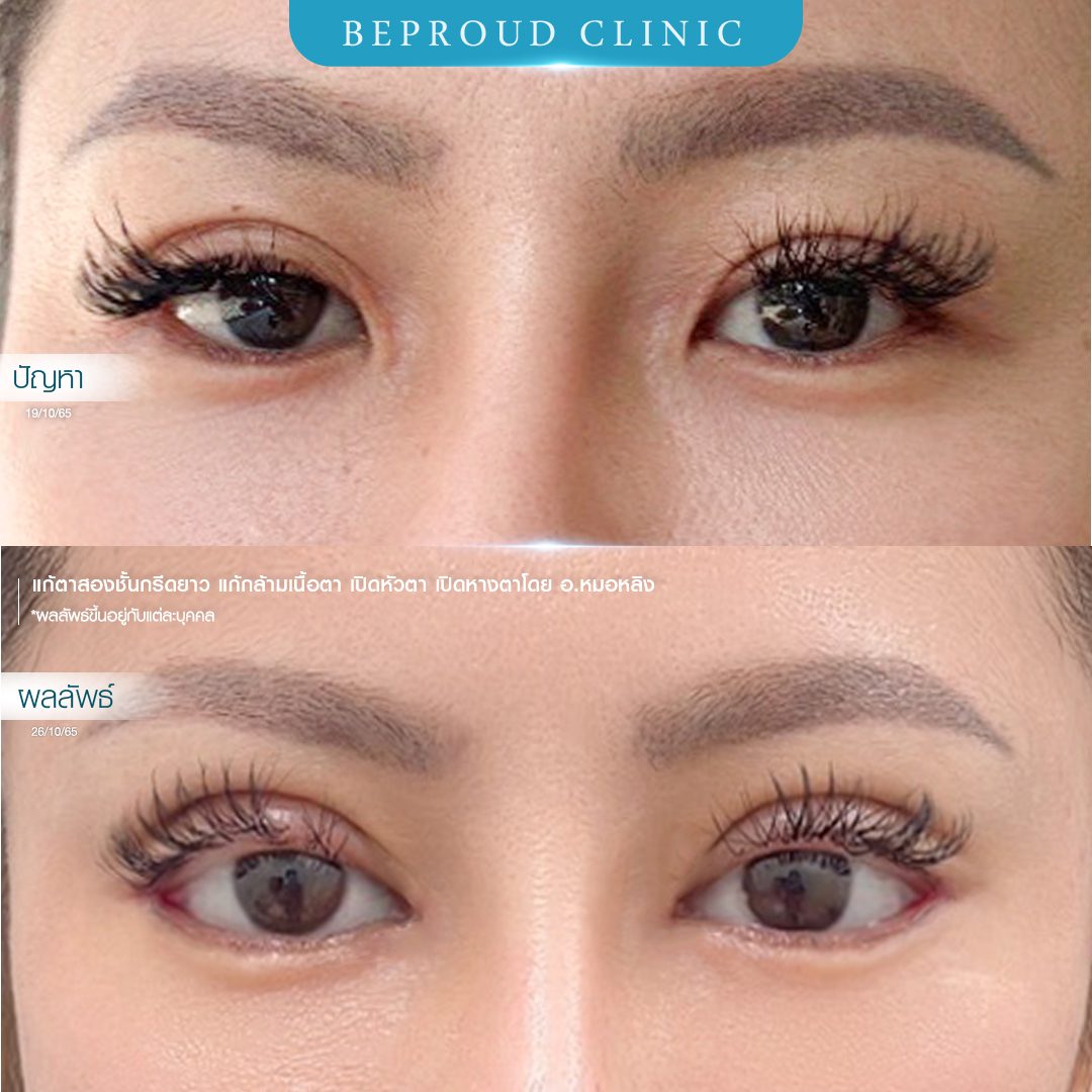 เปิดหางตา