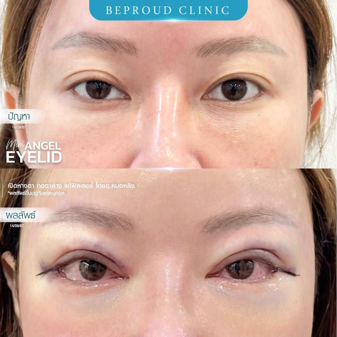 เปิดหางตา