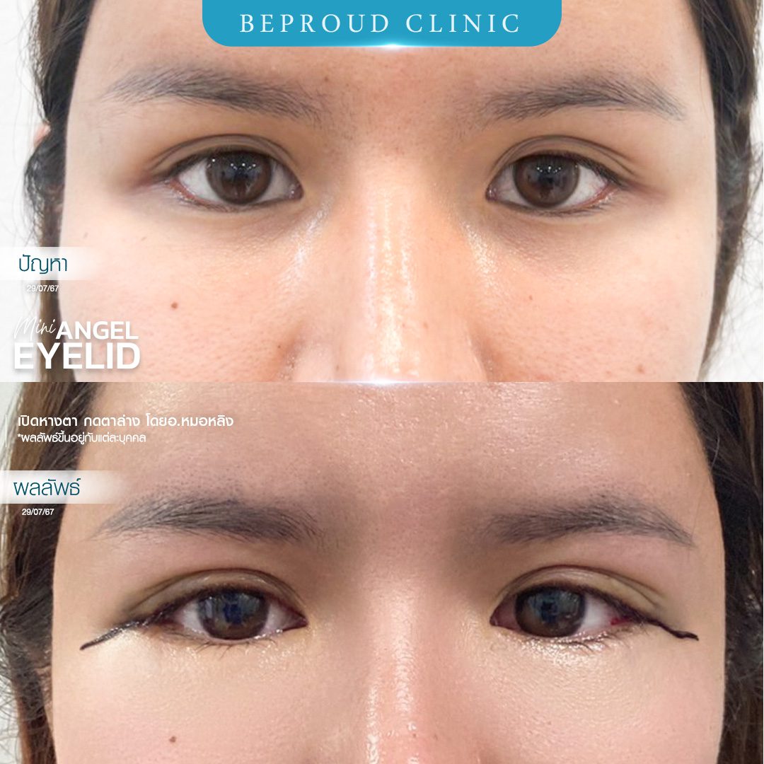 เปิดหางตา