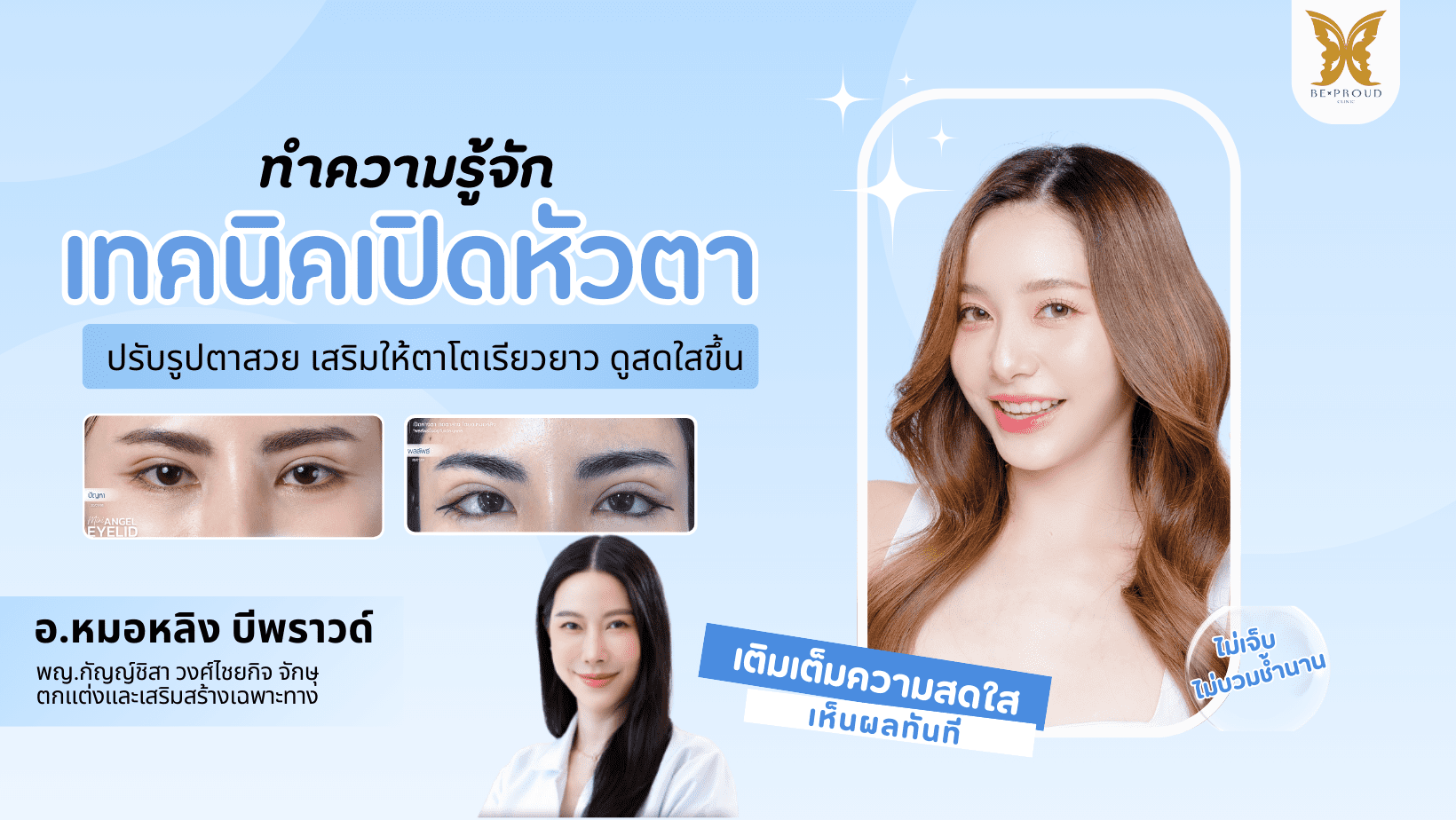 เปิดหัวตา, เปิดหัวตาคือ, เปิดหัวตาดีไหม, เปิดหัวตาเหมาะกับใคร, ข้อดีข้อเสียเปิดหัวตา, รีวิวเปิดหัวตา