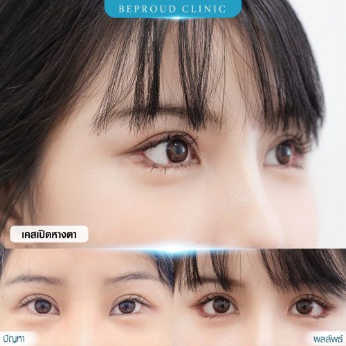 เม่เม่ เปิดหางตา กดหางตาล่าง211066 ก่อนหลัง.1 หน้าเต็ม-3ช่อง