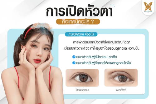 เปิดหัวตา, เปิดหัวตาคือ, เปิดหัวตาดีไหม, เปิดหัวตาเหมาะกับใคร, ข้อดีข้อเสียเปิดหัวตา, รีวิวเปิดหัวตา
