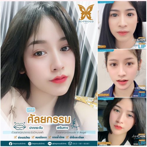 ปากกระจับ ปากกระจับ